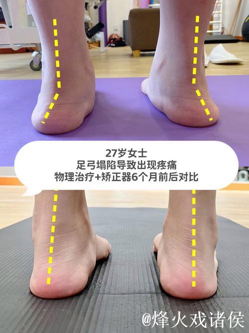 加福德:右脚踝状况改善明显,这是我近期感觉最好的一次 加福德:右脚踝状况改善明显,这是我近期感觉最好的一次